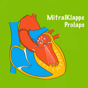 MitralKlappeProlaps