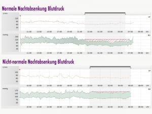 Medikamente bei Bluthochdruck am Abend