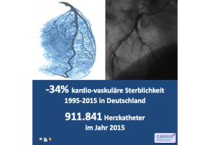 Selbsthilfe,Selbsthilfekurs,Koronarer Herzkrankheit,Herzkrankheit,Herzkatheter