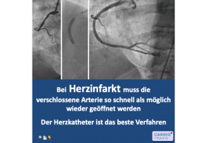 Selbsthilfe,Selbsthilfekurs,Koronarer Herzkrankheit,Herzkrankheit,Herzkatheter