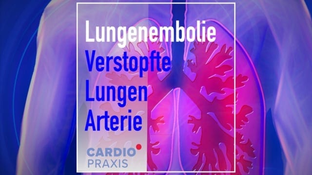 Wie Lange Kann Man Unbemerkt Eine Lungenembolie Haben www.cardiopraxis.de