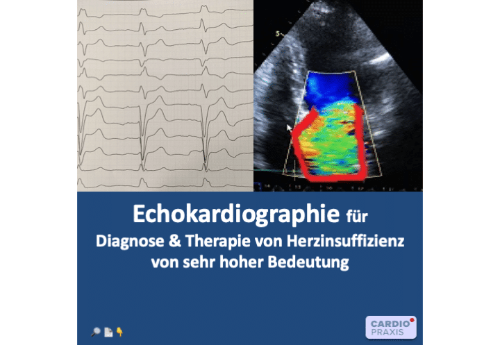 Kardiologe Düsseldorf,Kardiologe Meerbusch,Kardiologie Düsseldorf