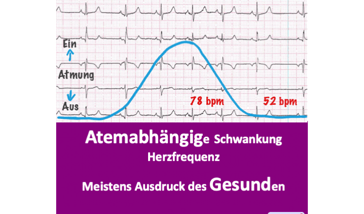 Warum es normal ist, dass die Herzfrequenz schwankt - Cardiopraxis