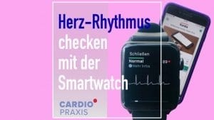 EKG mit Smartphone/Smartwatch erstellen