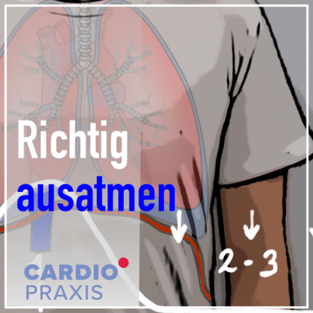Belastungs-EKG: solides und wichtiges Diagnostik-Tool - Cardiopraxis
