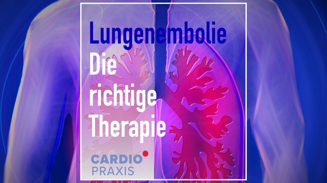 lungenembolie-womit-und-wie-lange-wird-sie-behandelt-cardiopraxis