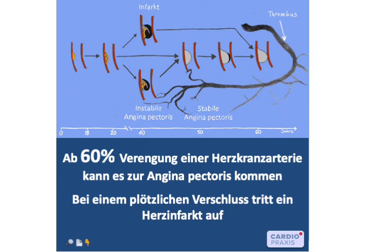 Kardiologe Düsseldorf,Kardiologe Meerbusch,Kardiologie Düsseldorf