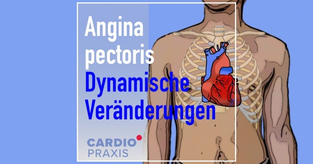 instabile Angina pectoris Cardiopraxis