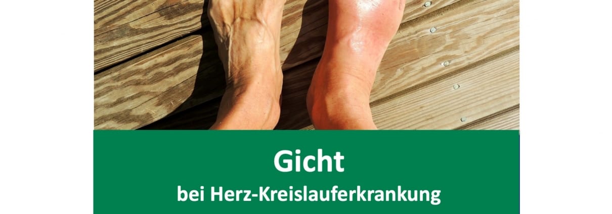 Zu Hohe Harnsäure Was Tun www.cardiopraxis.de
