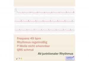 EKG mit Smartphone/Smartwatch erstellen