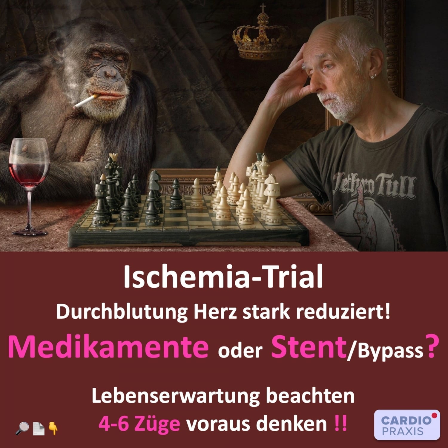 Enge Herzarterien: Stent, Bypass oder nur Medikamente? | | Cardiopraxis®