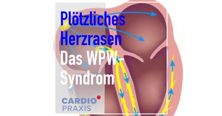 Herzrasen | | Cardiopraxis