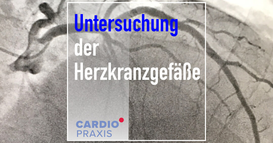 Untersuchung der Herzkranzgefäße