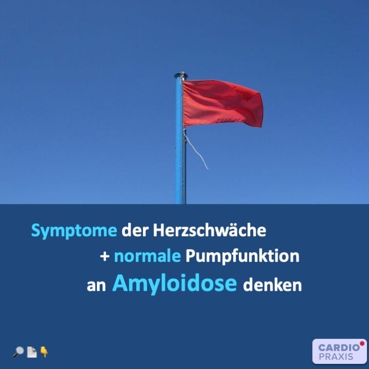 Kardiale Amyloidose,Ursachen,Therapie,Diagnostik,Behandlung,Prognose