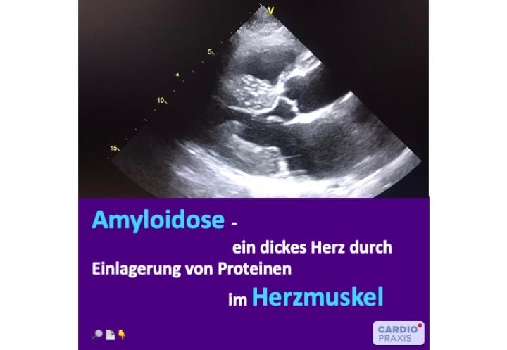 Kardiologe Düsseldorf,Kardiologe Meerbusch,Kardiologie Düsseldorf