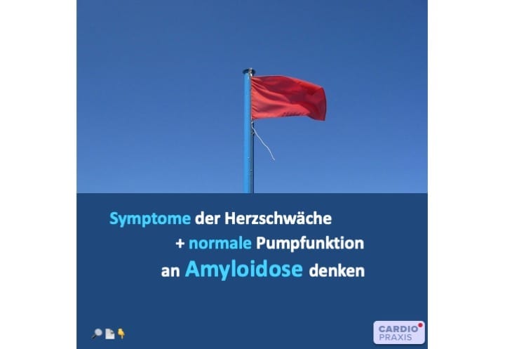 Kardiale Amyloidose,Ursachen,Therapie,Diagnostik,Behandlung,Prognose