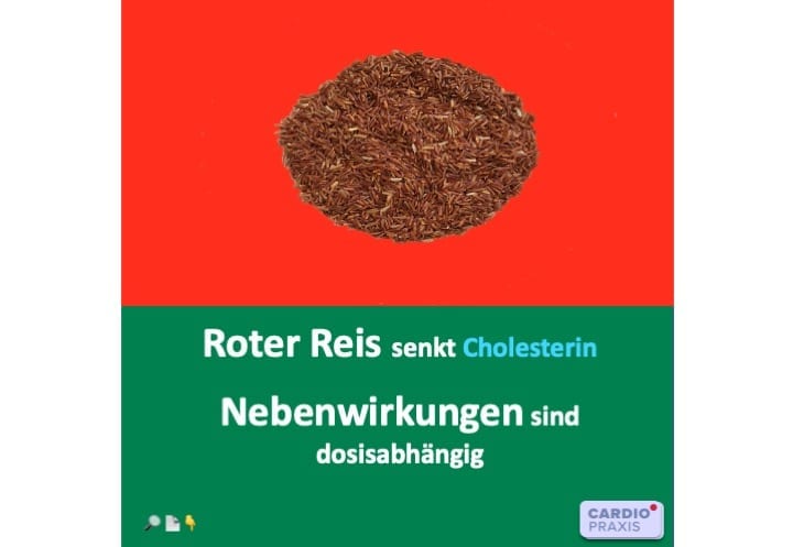 https://www.cardiopraxis.de/wp-content/uploads/2020/09/cholesterin-roter-reis.jpg