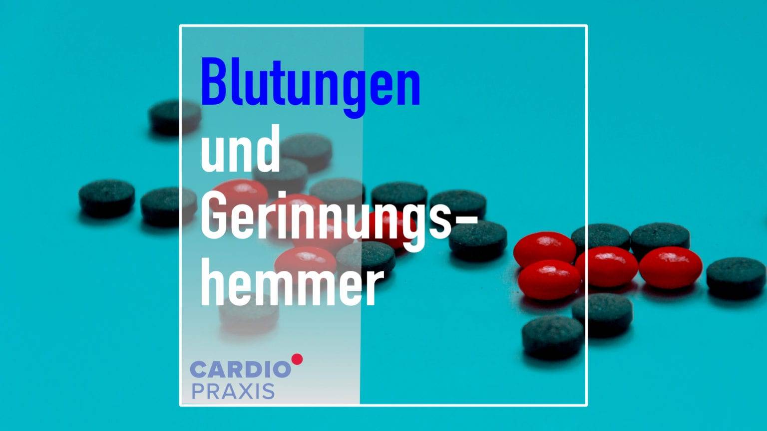 Histamin – Freisetzung, Funktion und Abbau im Körper | | Cardiopraxis