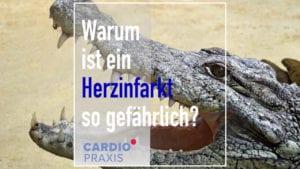 Wir alle wissen, ein Herzinfarkt ist gefährlich. Aber was passiert dabei eigentlich und warum sterben Menschen plötzlich am Herzinfarkt? Wir klären auf.