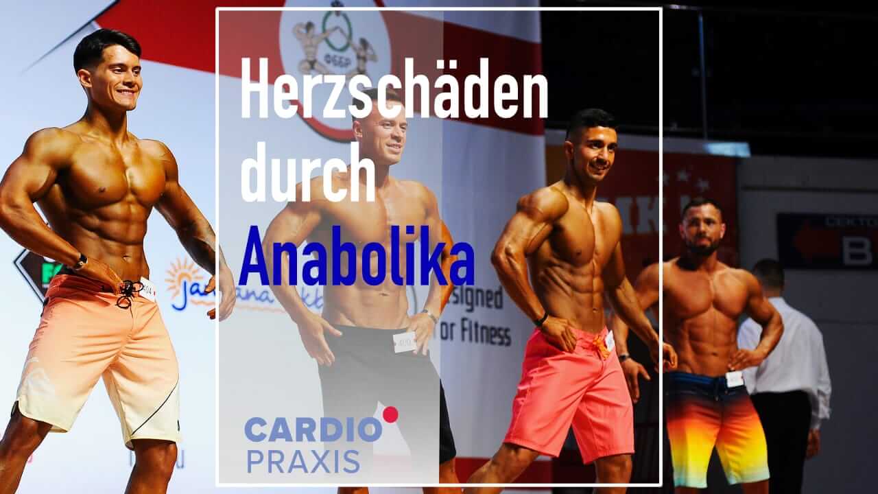 Willkommen zu einem neuen Look von zyzz tot steroide