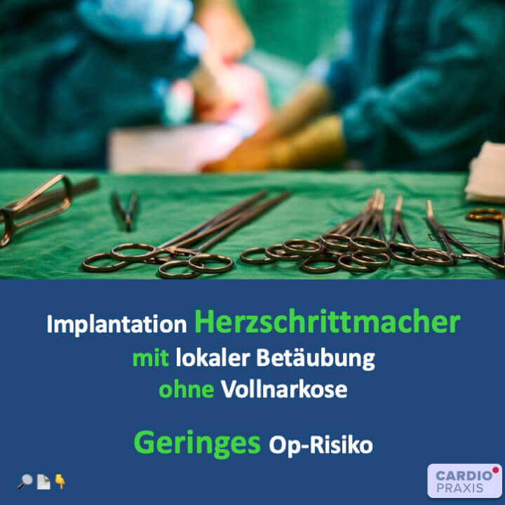 Implantation des Herzschrittmachers ohne Vollnarkose - Geringes OP-Risiko