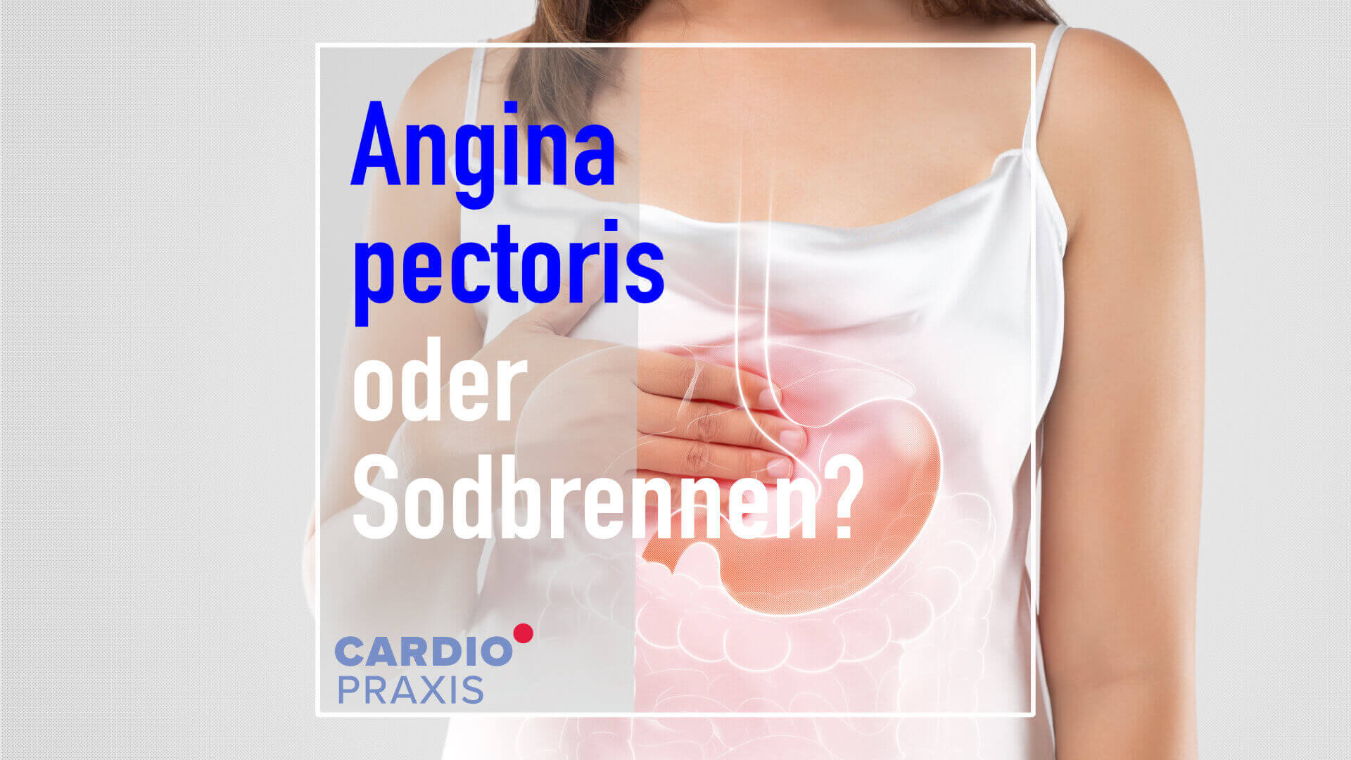 Angina Pectoris oder Sodbrennen: Ähnliche Symptome sorgen oft für Unsicherheit. Wann sollten Sie zum Arzt?