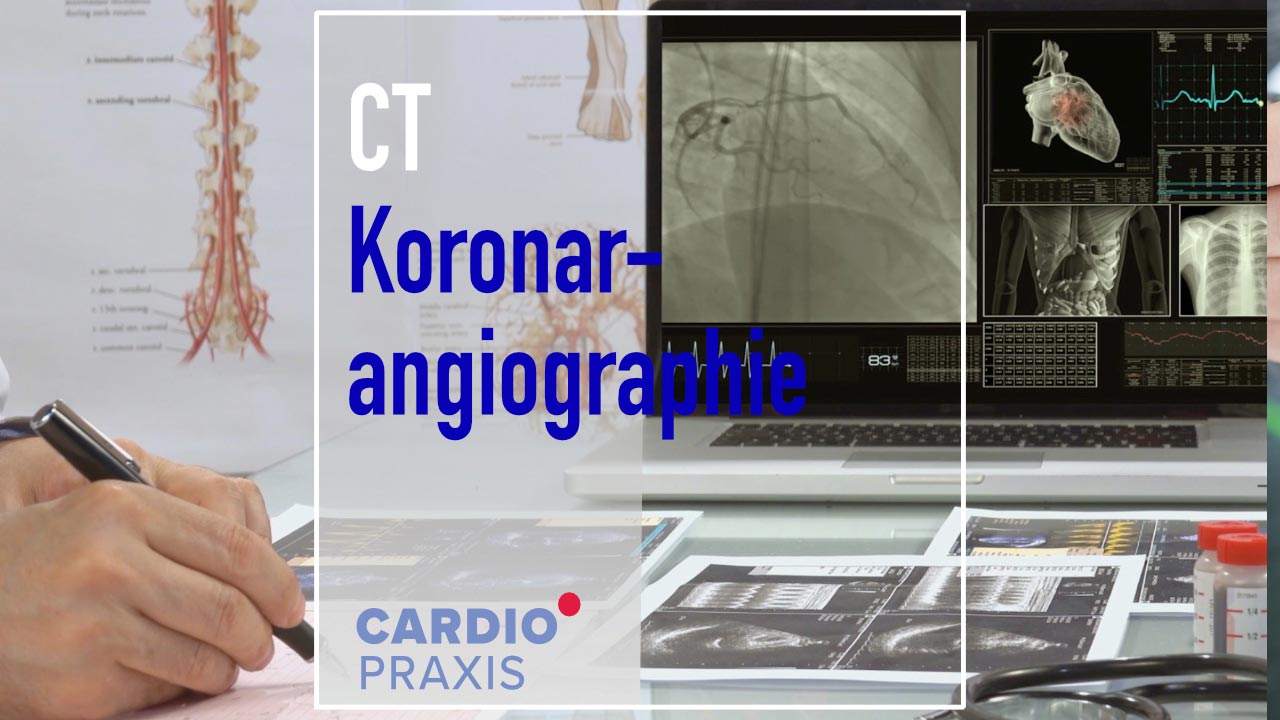 ct koronarangiographie