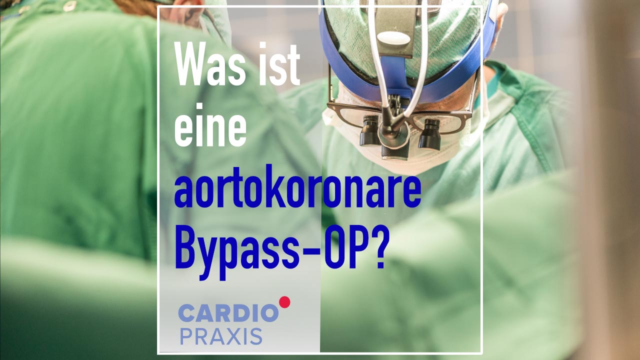 Was ist eine Bypassoperation?