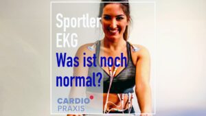 sportler ekg was ist noch normal